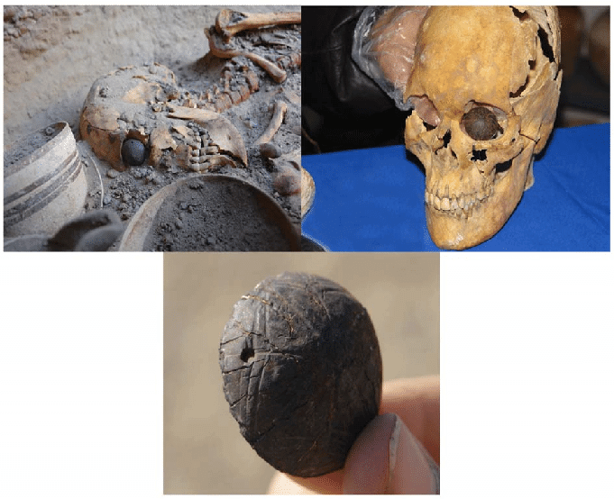 이란 샤르 에 소흐타 (Shahr-i Sokhta) - 불타버린 도시, 5천 년 전의 뇌수술과 인조 안구의 미스터리 1 세계 최초의 인조 안구 이미지
출처: https://www.researchgate.net/